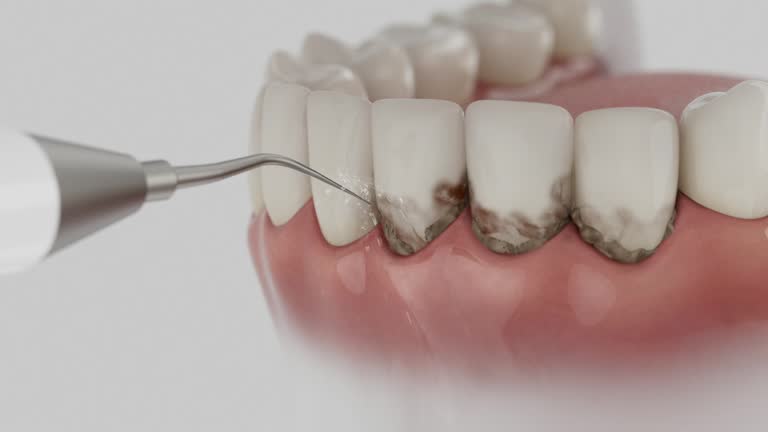 Reliable Dental Implants contractor in Archer Lodge, NC by Smile Center Dentistry
